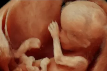 Best Ultrasound Centre in Mohali, Female Doctor for Ultrasound, Female Ultrasonologist in Mohali, Clags Centre in Airport Road Mohali